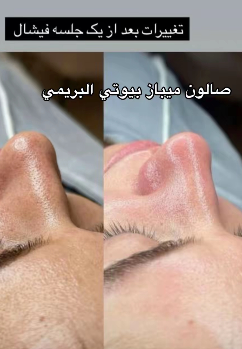 ♥جلسة فيشال